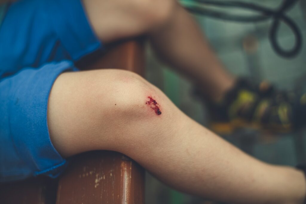 Close-up of a child's knee with a small, bleeding scrape, wearing blue shorts, resting on a wooden surface.